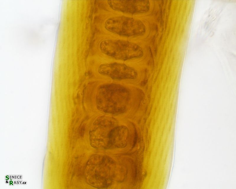 Scytonema