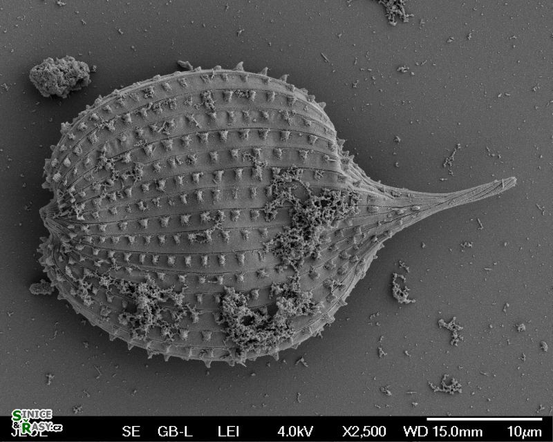 Phacus monilatus
