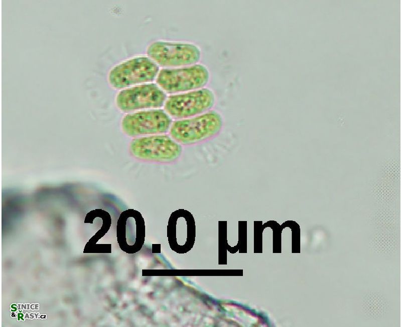 Scenedesmus obtusus var. disciformis