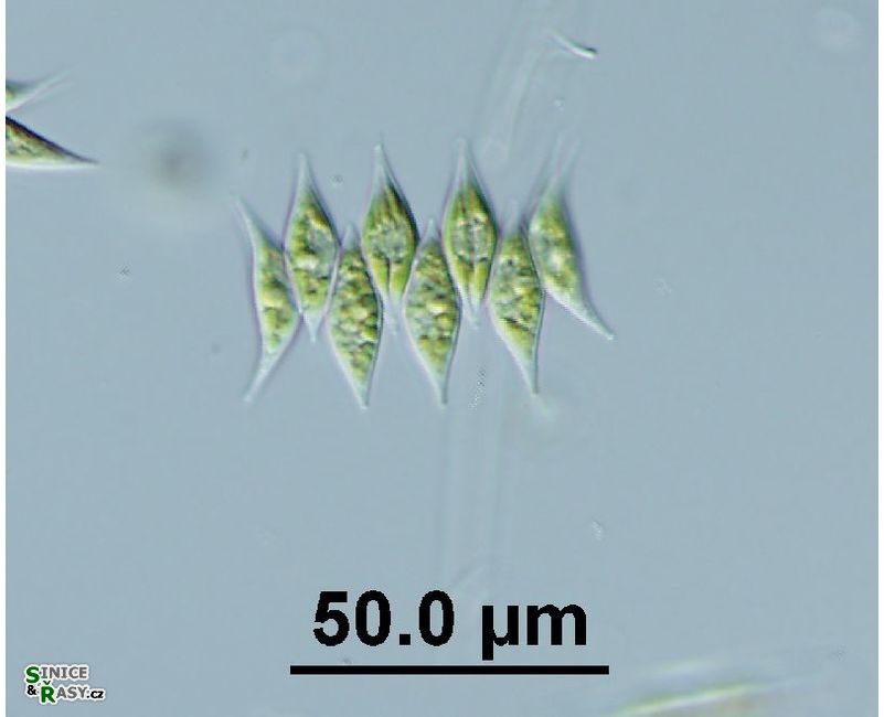 Tetradesmus obliquus