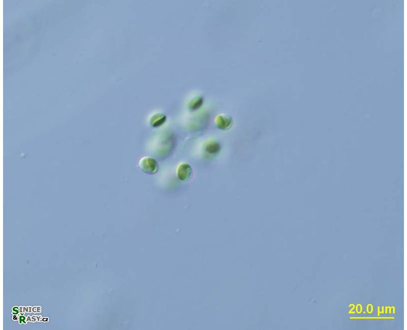 Dictyosphaerium cf. *ehrenbergianum*