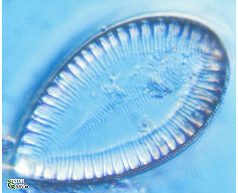 Surirella ovalis