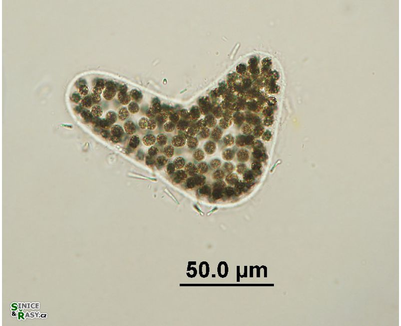 Microcystis wesenbergii