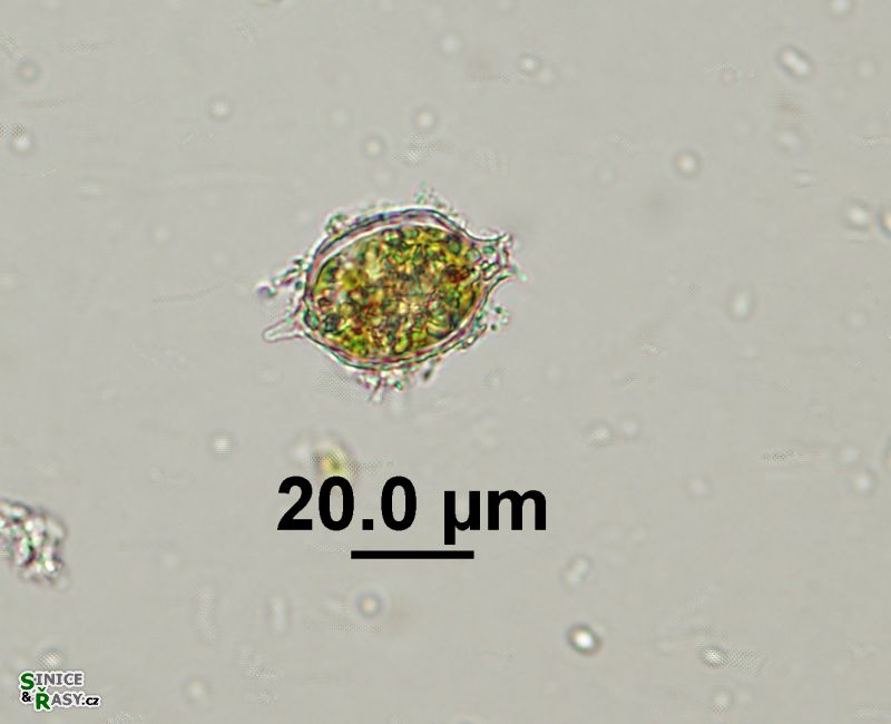 Strombomonas acuminata