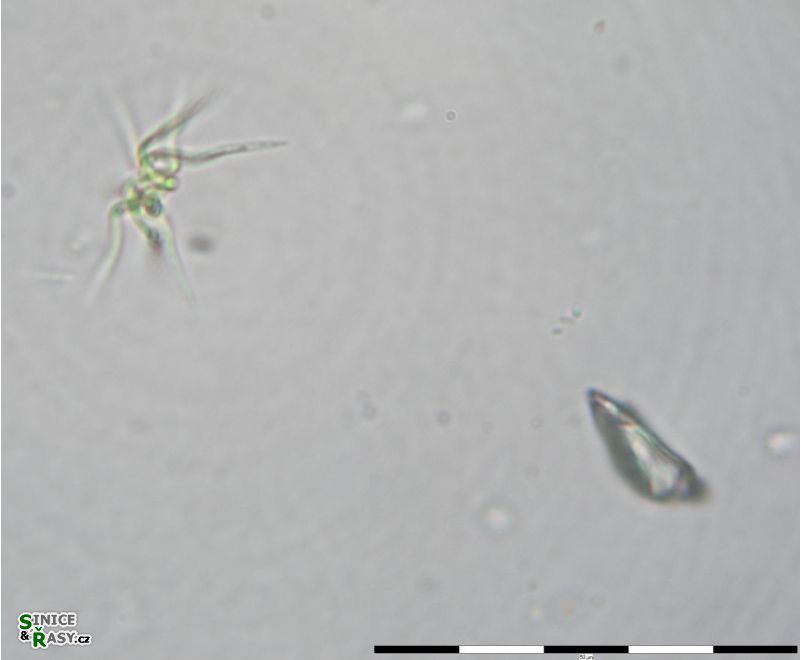 Ankistrodesmus spiralis