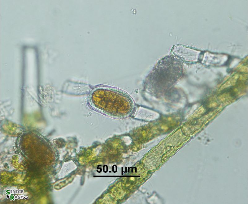 Bulbochaete sp.
