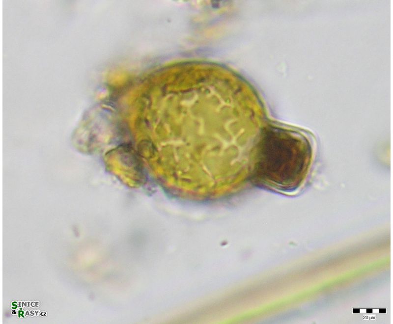 Melosira varians