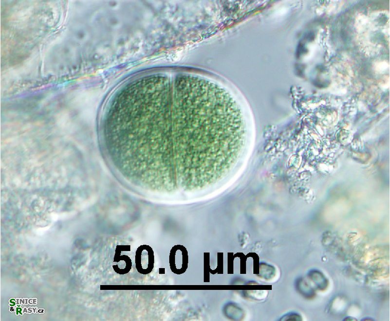 Chroococcus turgidus