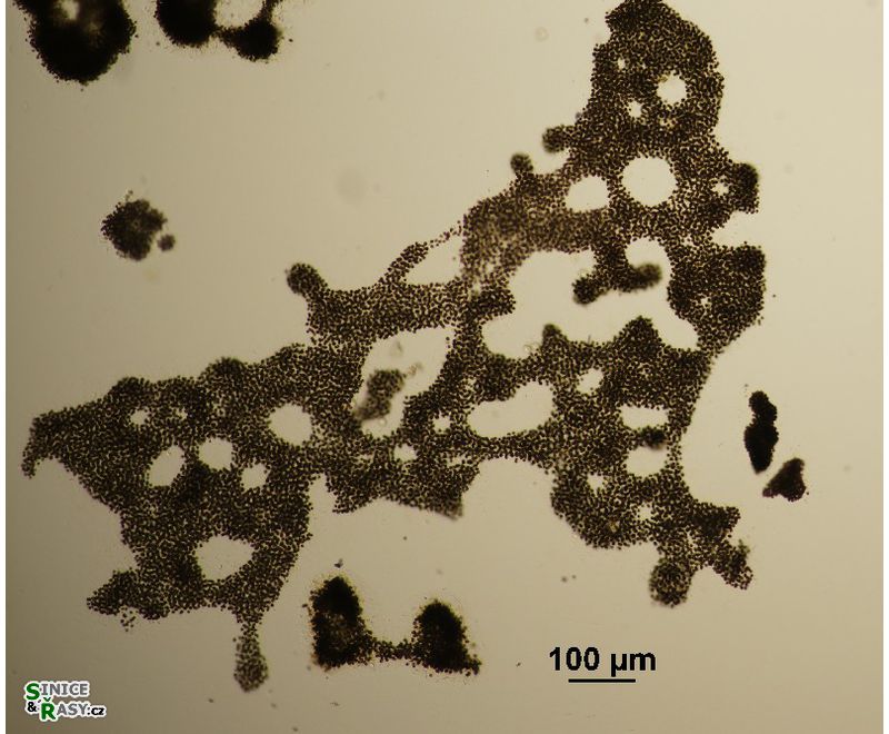 Microcystis aeruginosa 