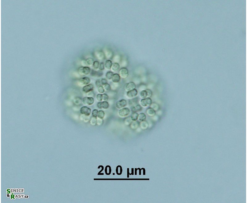 Woronichinia ruzickae