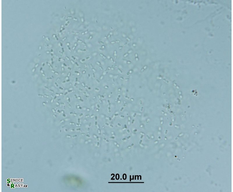 Cyanodictyon planctonicum