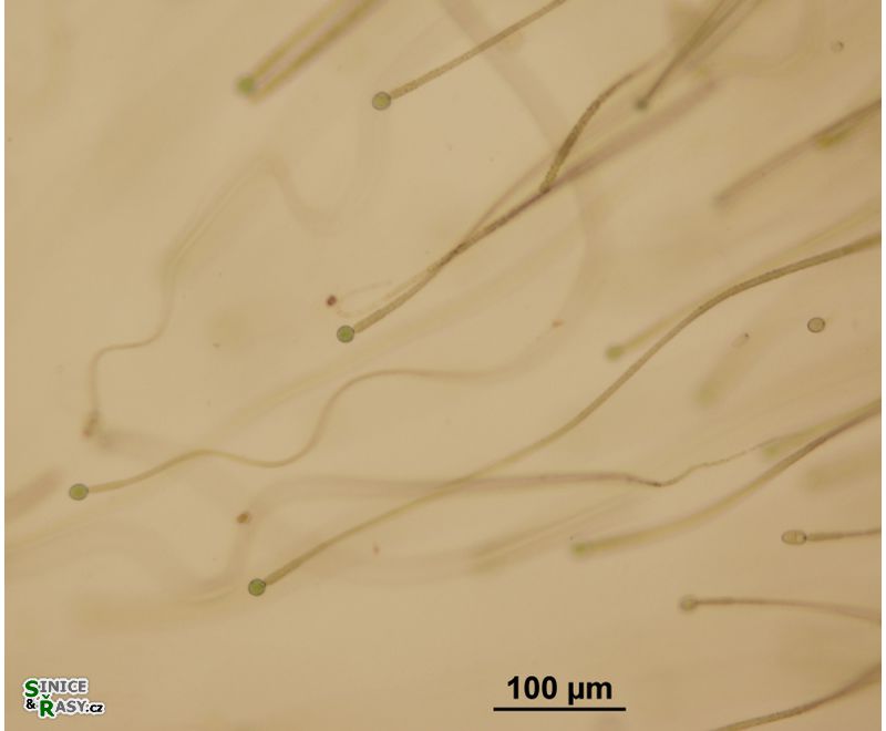 Gloeotrichia intermedia