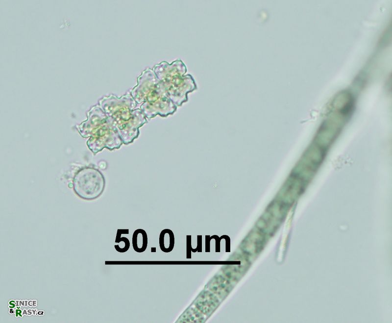 Euastrum dubium