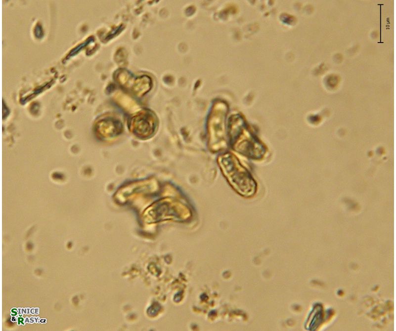 Dimorphococcopsis