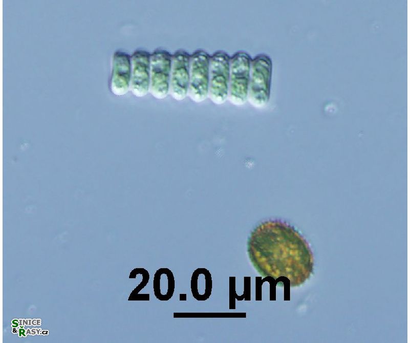 Scenedesmus ellipticus