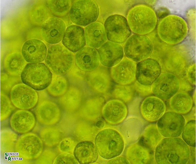 Spongiochloris