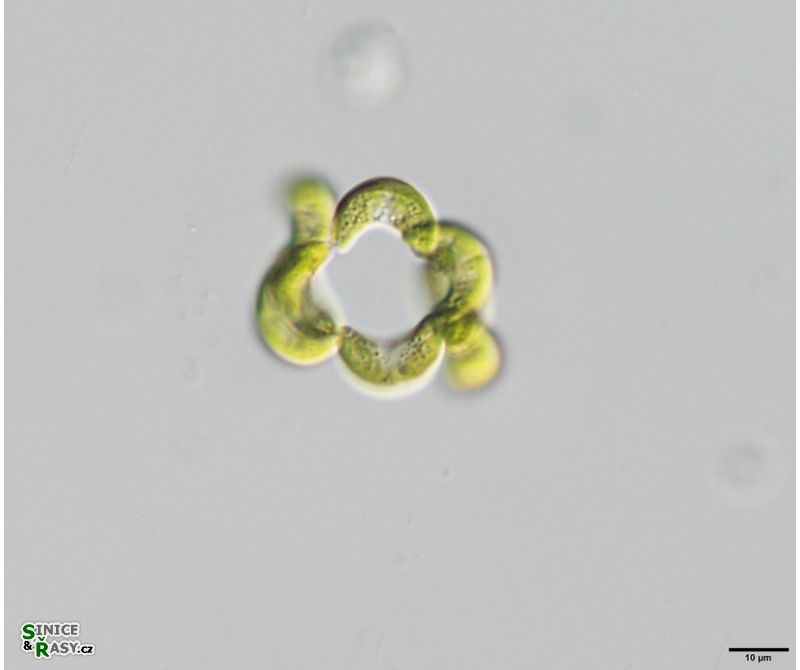 Tetrallanthos lagerheimii