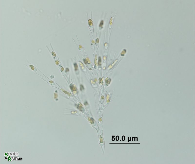 Dinobryon divergens
