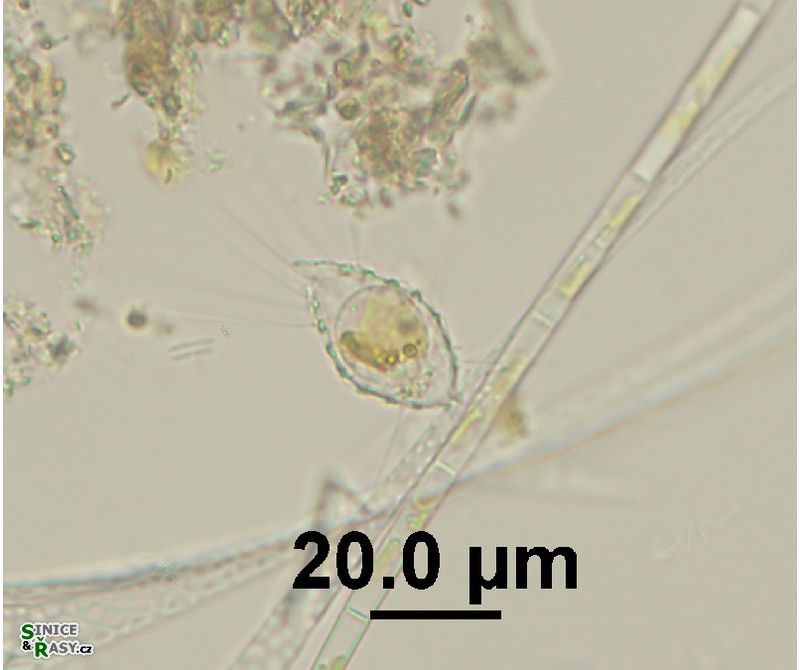 Mallomonas sp. 