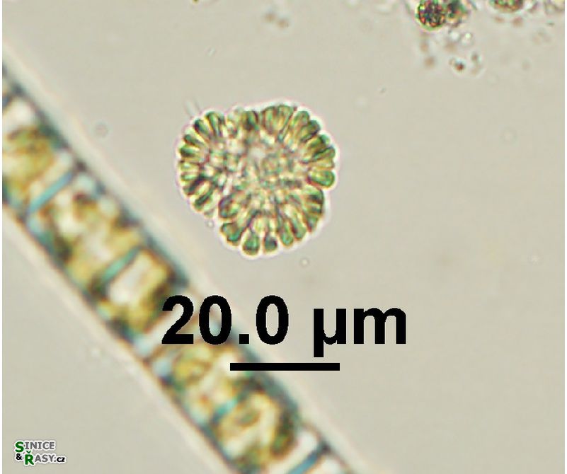 Woronichinia cf. karelica
