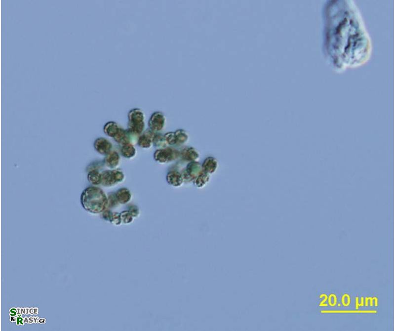 Dolichospermum compactum