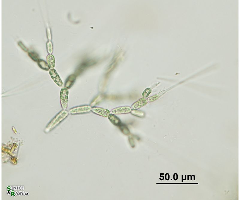 Batrachospermum gelatinosum
