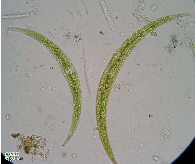 Closterium