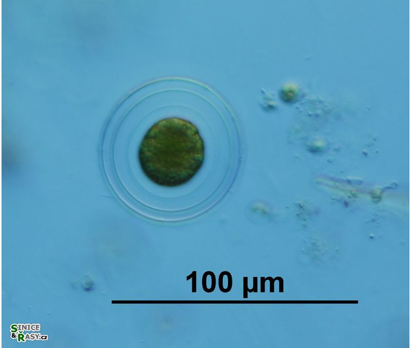 Asterococcus superbus