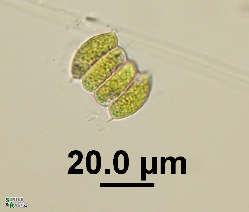 Scenedesmus bijuga