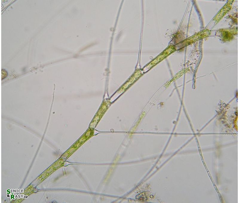 Bulbochaete