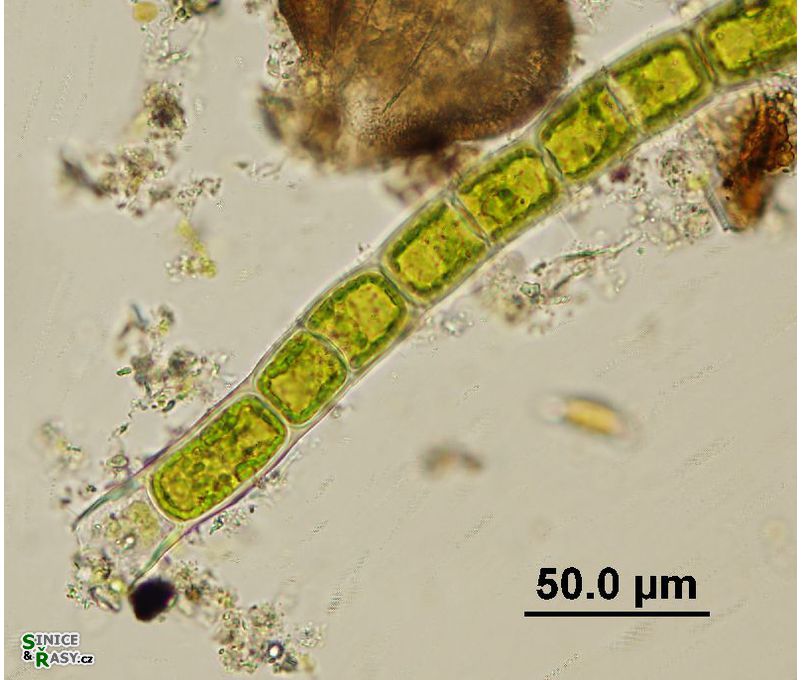 Microspora sp. 