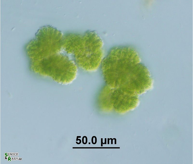 Botryococcus braunii