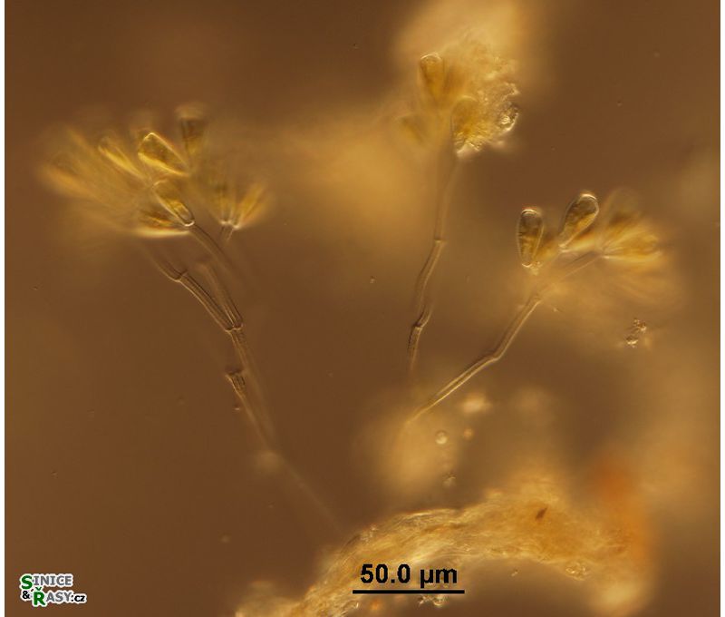 Gomphonema sp. 