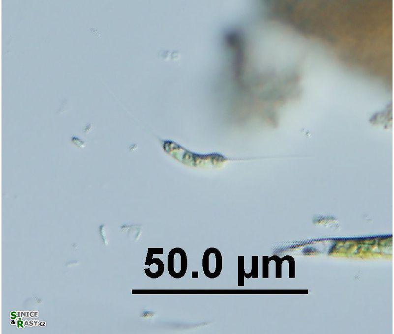 Ophiocytium capitatum