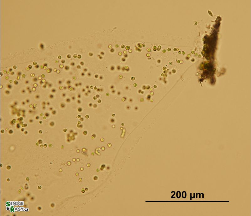 Tetraspora gelatinosa