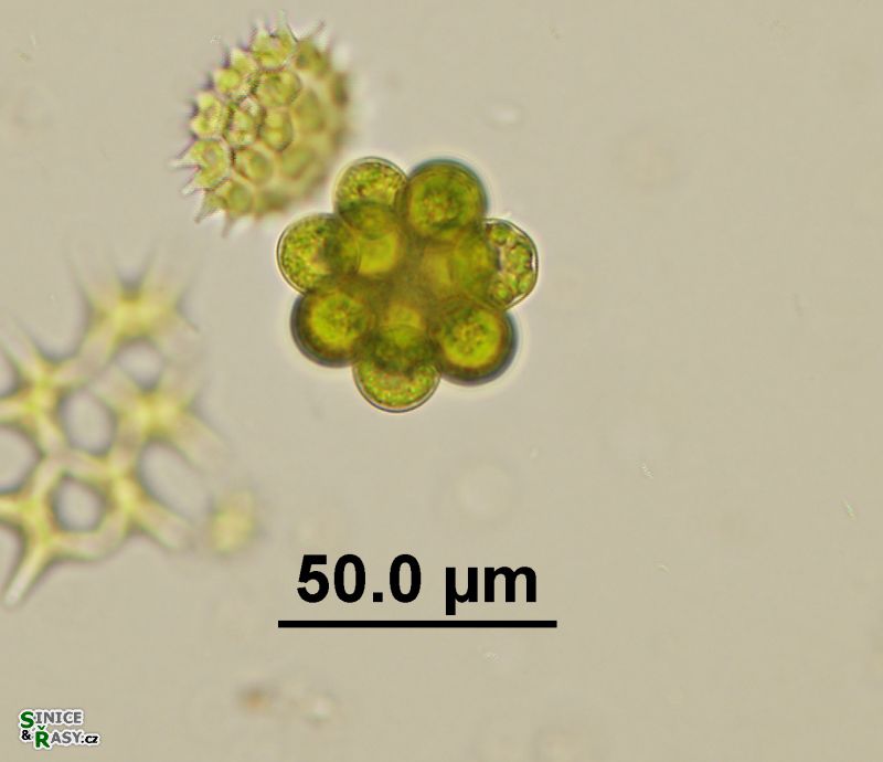Coelastrum microporum