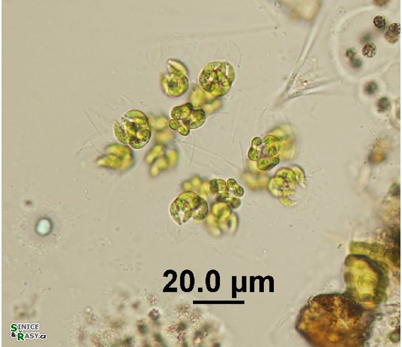 Kirchneriella lunaris