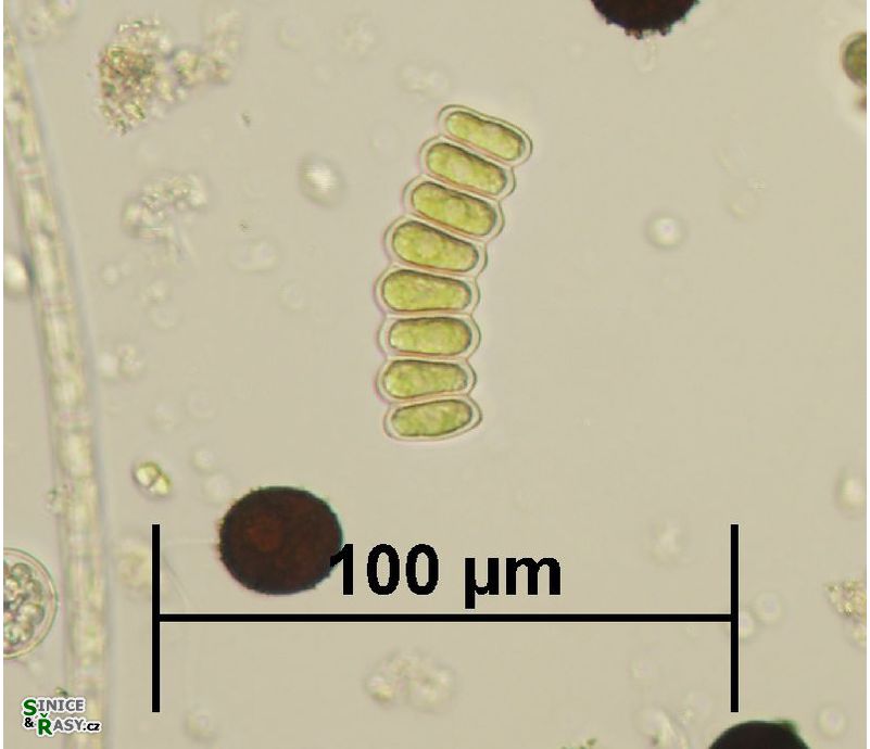 Scenedesmus ellipticus