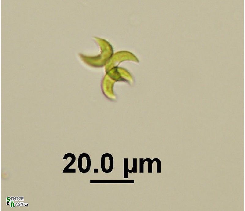 Selenastrum bibraianum