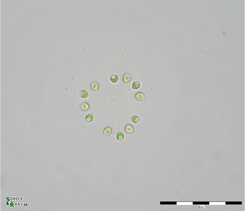 Mucidosphaerium sphagnale