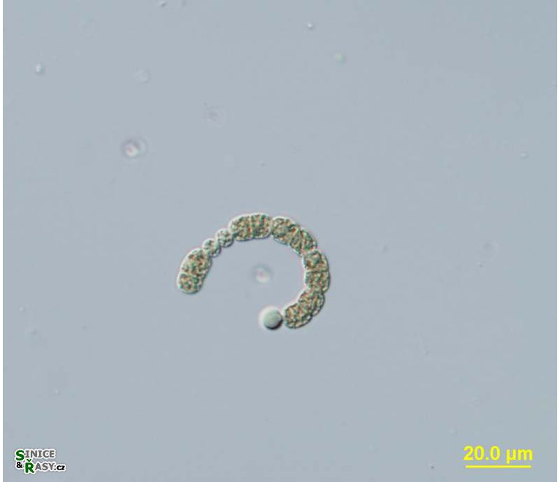 Anabaenopsis