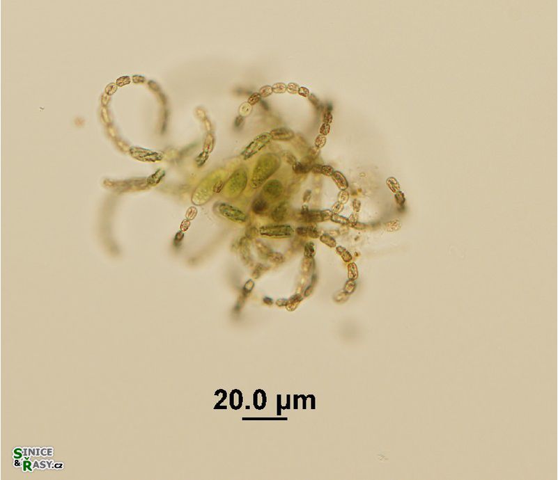 Dolichospermum lemmermanii