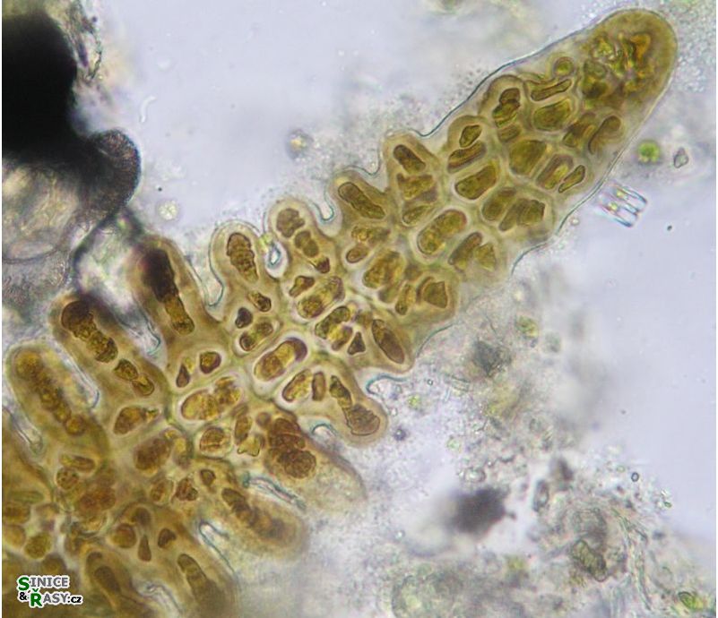 Stigonema mamillosum