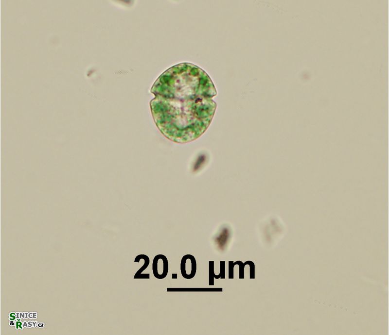 Nusuttodinium aeruginosum