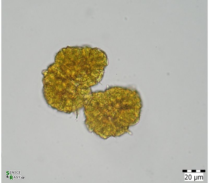 Botryococcus braunii