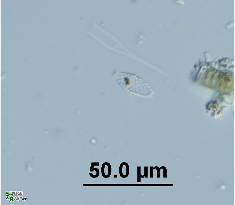 Mallomonas cf. allorgei