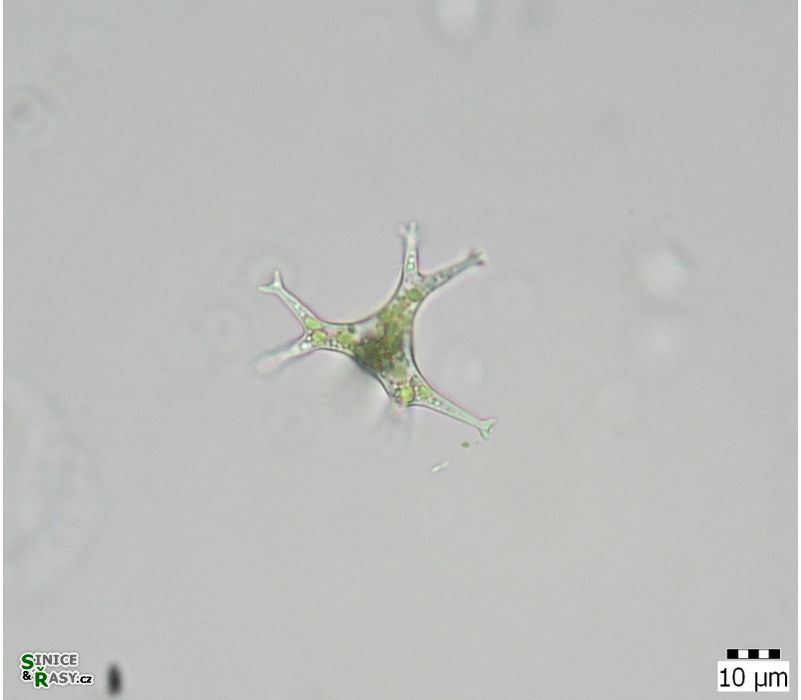 Pseudostaurastrum limneticum