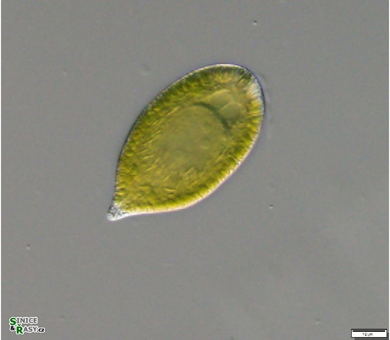 Gonyostomum semen