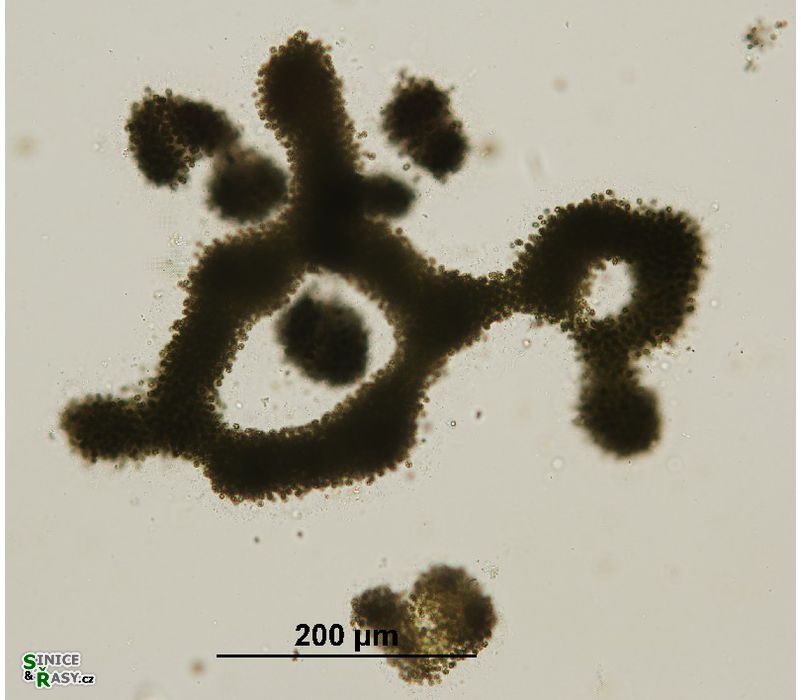 Microcystis aeruginosa
