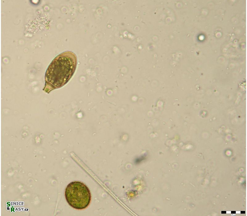 Trachelomonas bulla